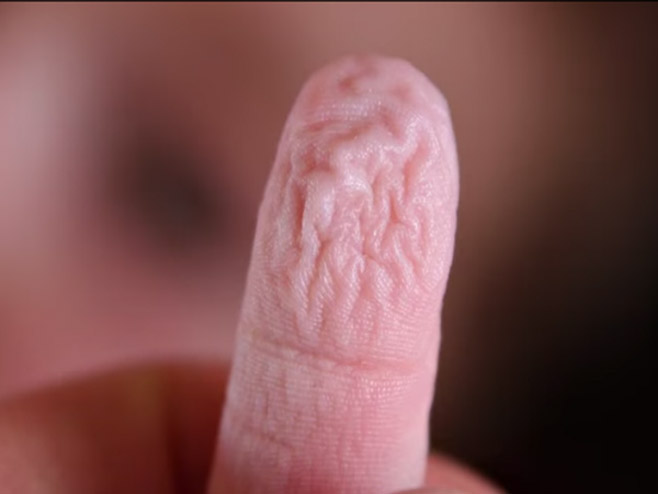 Smežurani prsti - Foto: Screenshot/YouTube