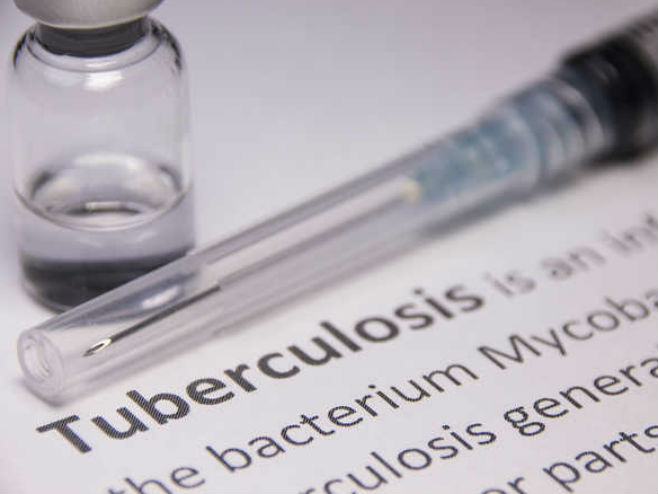 Vakcina protiv tuberkuloze - Foto: ilustracija